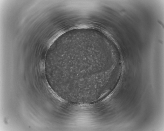 X0000099381417200805291119