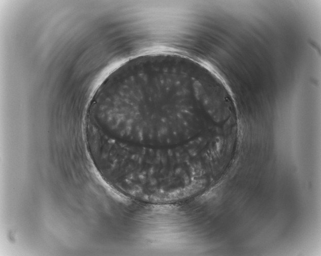 X0000099381429200805291119