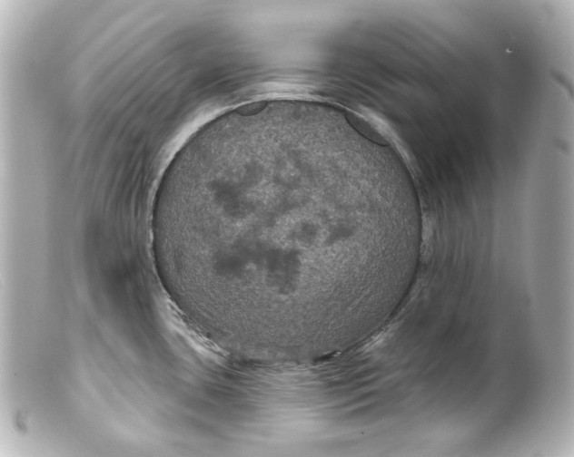 X0000099381435200805291119