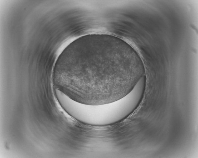 X0000099381440200805291119