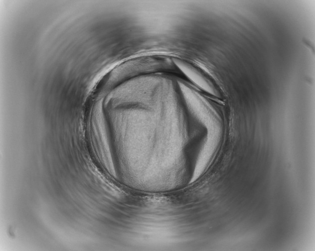 X0000099381452200805291118