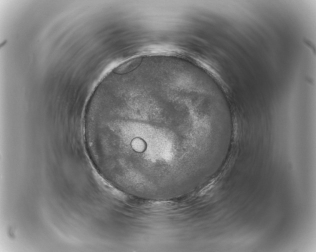 X0000099381471200805291118