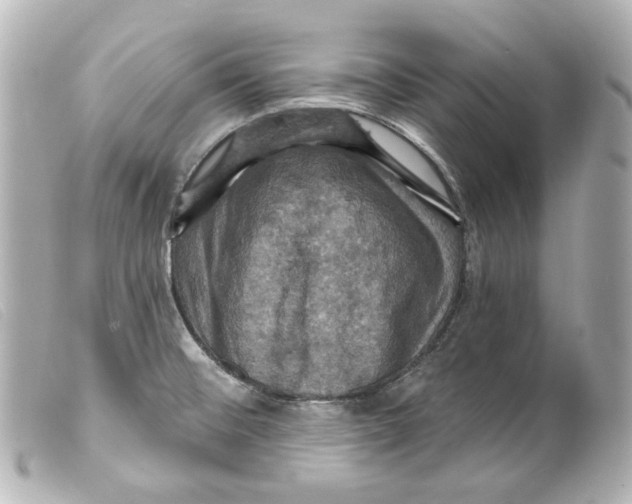 X0000099381476200805291118