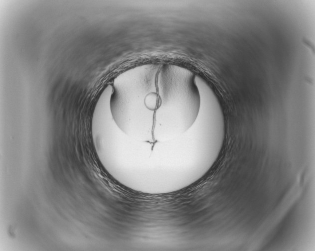 X0000099381492200805291117