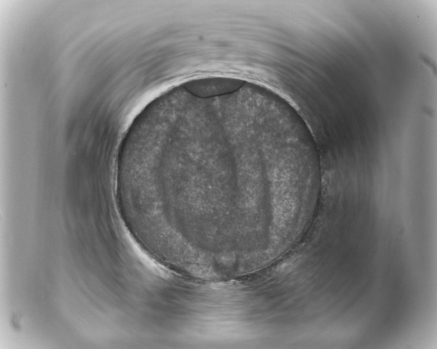 X0000099381523200805291118