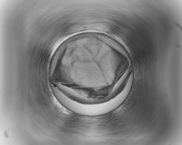 X0000099381532200805291118