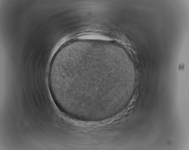 X0000099380003200806051131