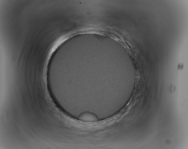 X0000099380006200806051131