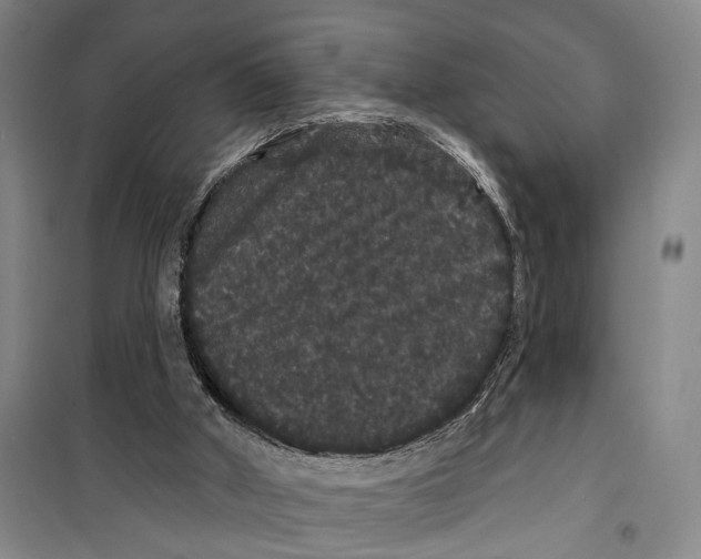 X0000099380010200806051131