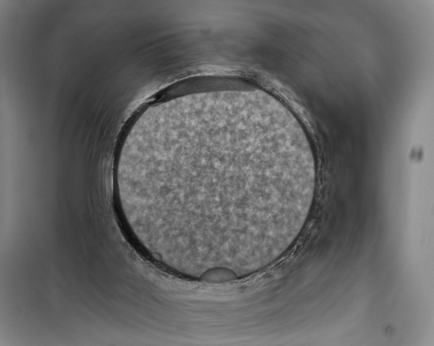 X0000099380011200806051131