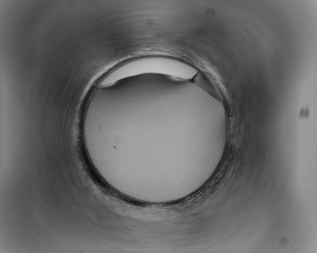 X0000099380012200806051131
