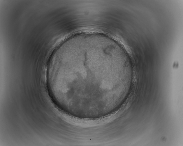 X0000099380014200806051131