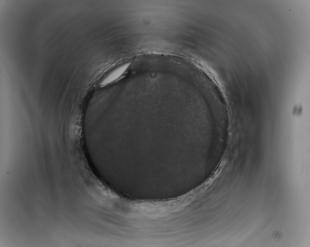 X0000099380017200806051131