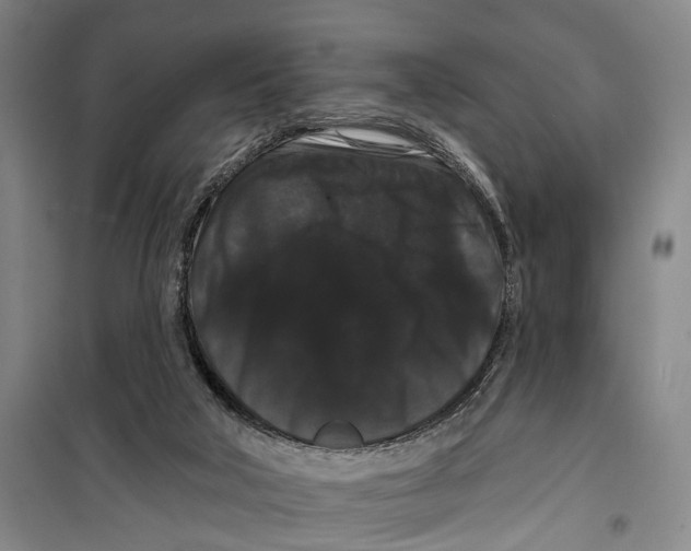 X0000099380018200806051131