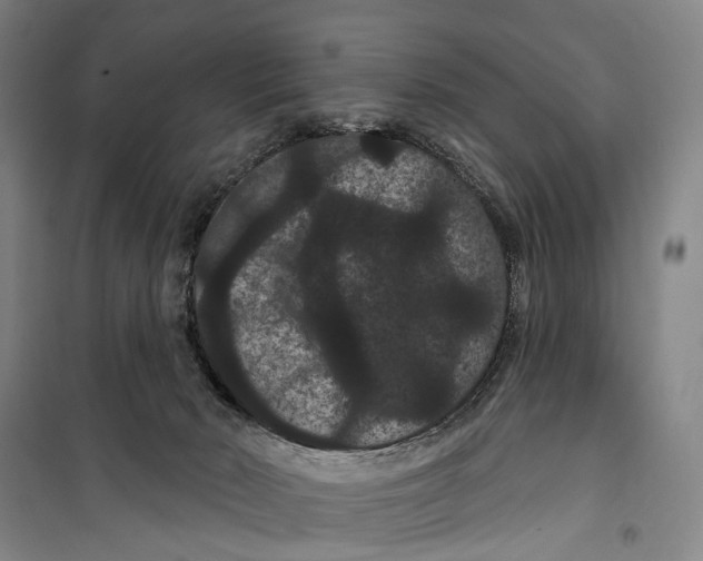 X0000099380030200806051131