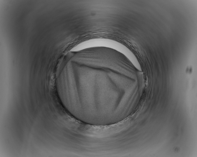 X0000099380037200806051131
