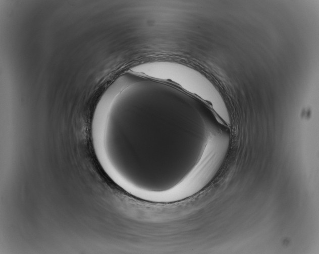 X0000099380039200806051131