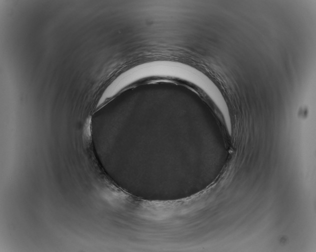 X0000099380041200806051131