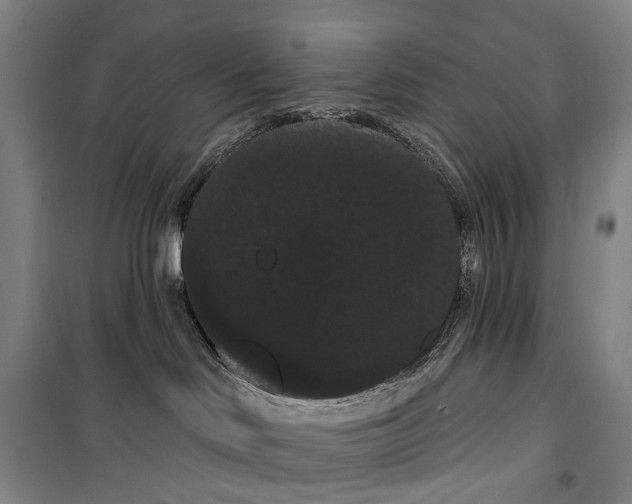X0000099380046200806051131