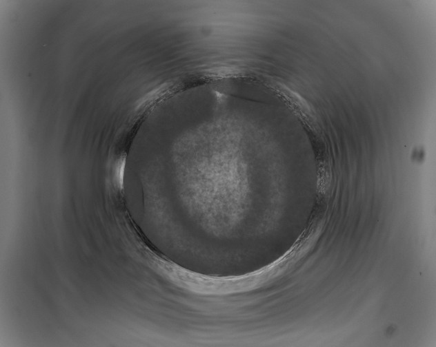 X0000099380047200806051131