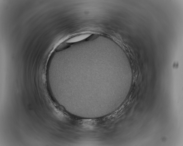X0000099380050200806051130