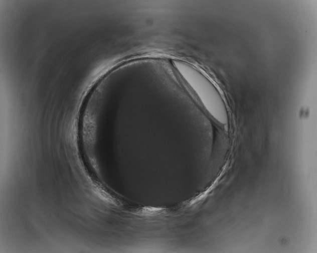 X0000099380055200806051130
