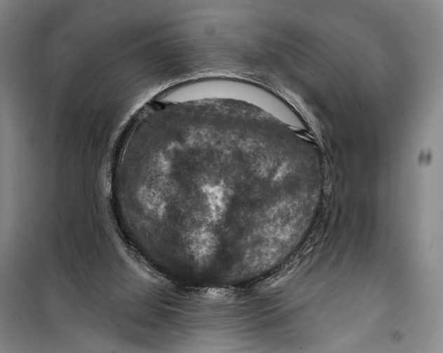 X0000099380060200806051130