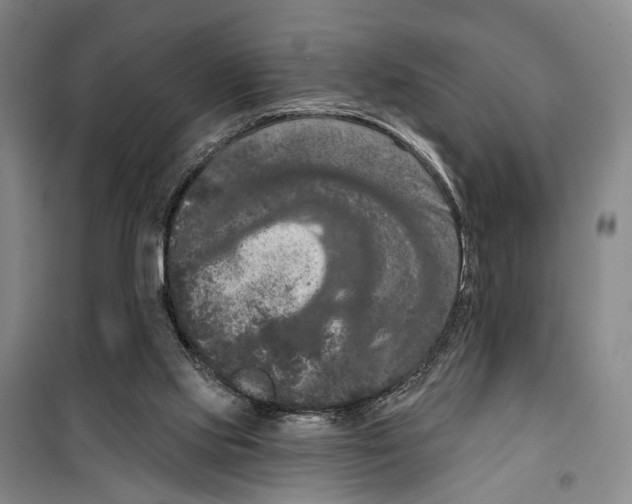 X0000099380061200806051130