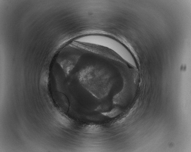 X0000099380063200806051130