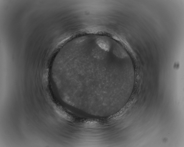 X0000099380066200806051130