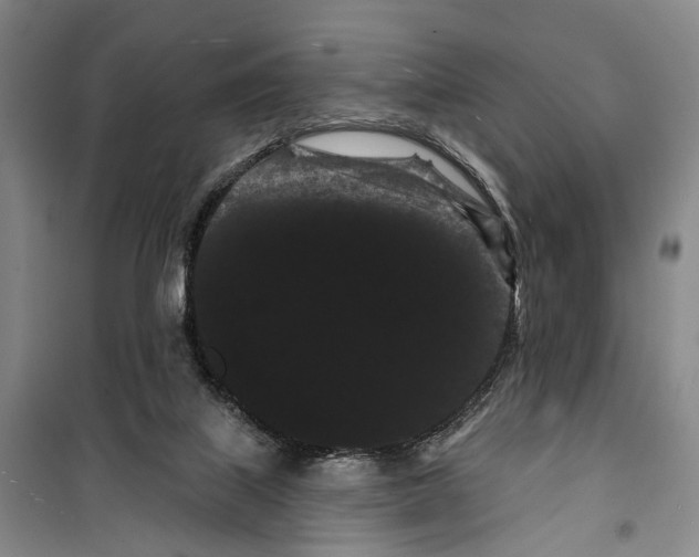 X0000099380067200806051130