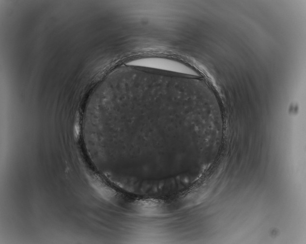 X0000099380069200806051130