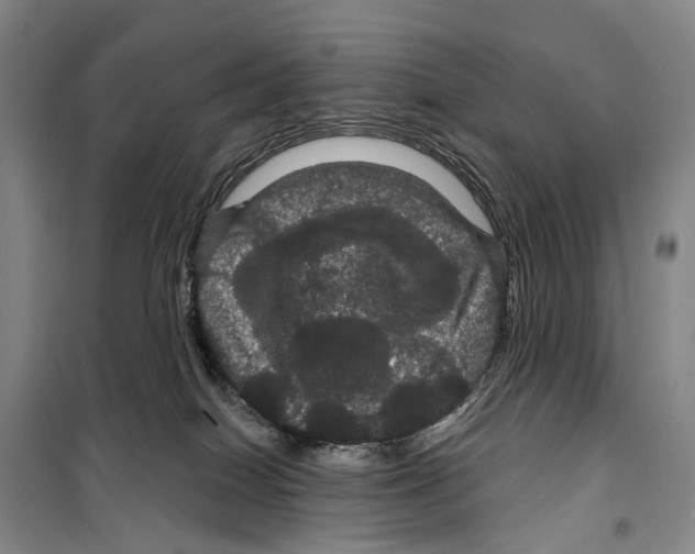 X0000099380086200806051131