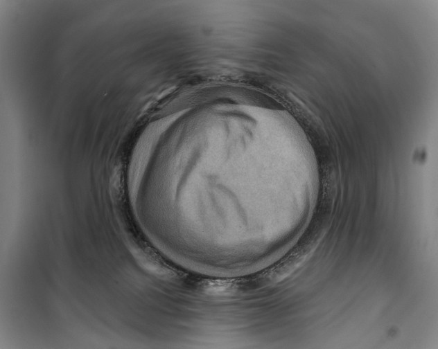 X0000099380088200806051131
