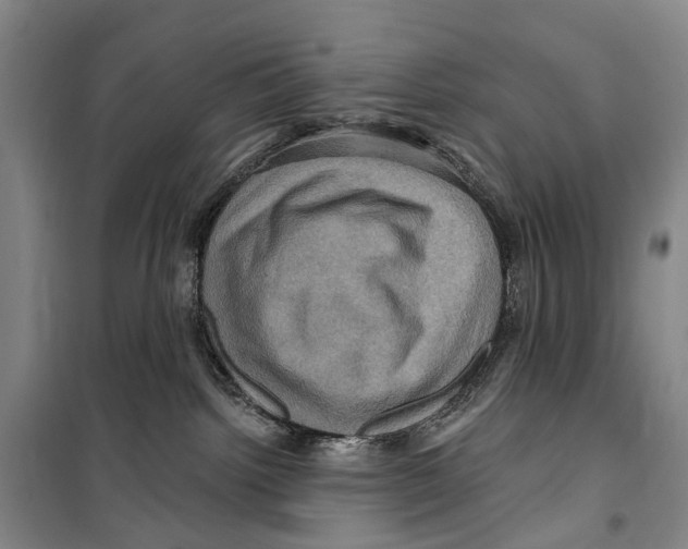 X0000099380092200806051131