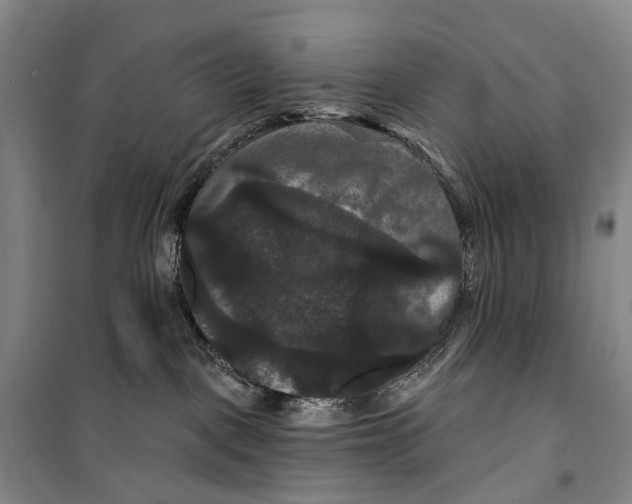 X0000099380093200806051131