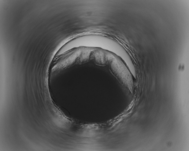 X0000099380100200806051130