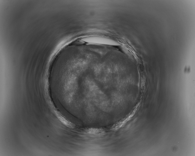 X0000099380101200806051130