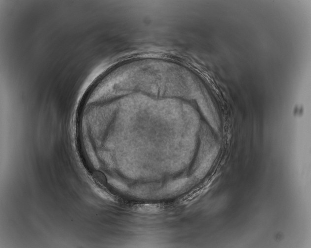 X0000099380102200806051130