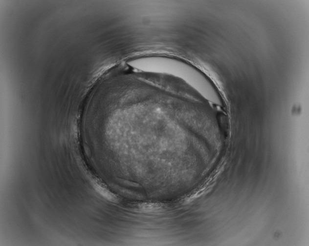 X0000099380105200806051130