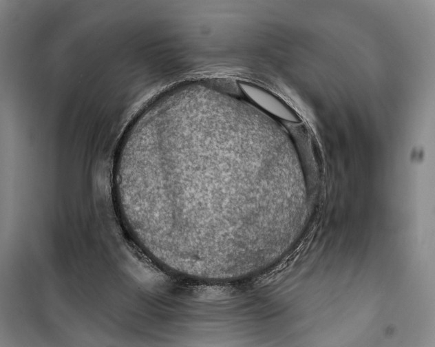 X0000099380107200806051130
