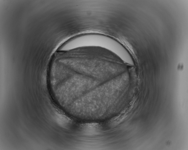 X0000099380108200806051130