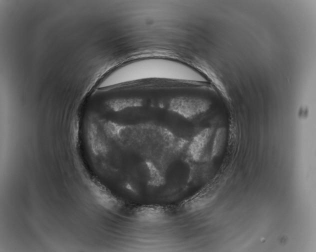 X0000099380110200806051130