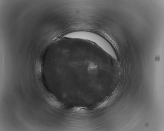 X0000099380117200806051130