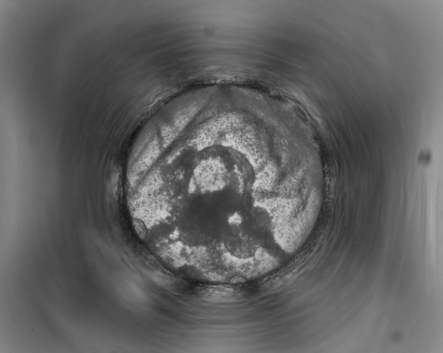 X0000099380123200806051130