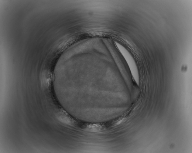 X0000099380125200806051130