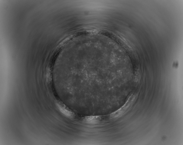 X0000099380136200806051129