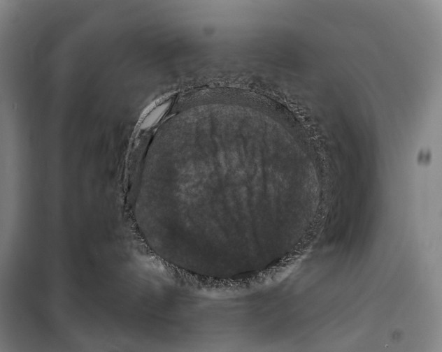 X0000099380144200806051129