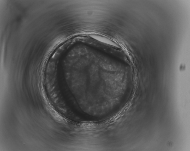X0000099380145200806051129