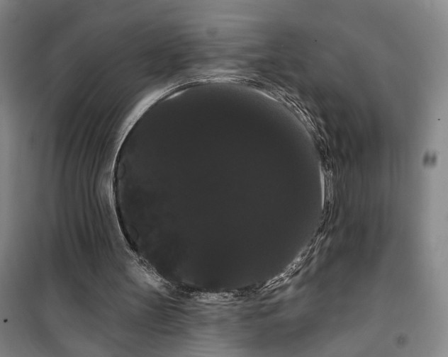X0000099380147200806051129